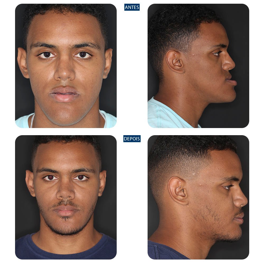 Casos-novos-13