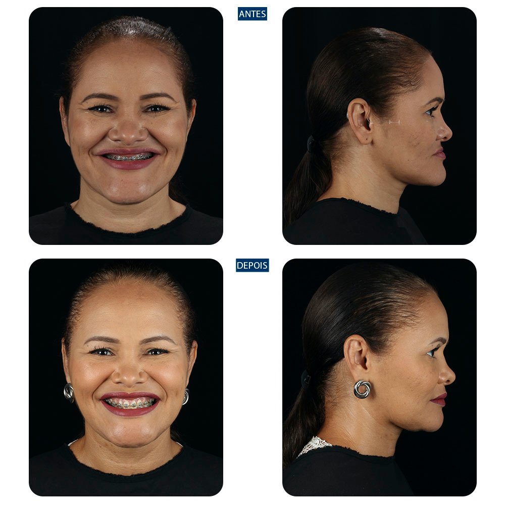 Casos-novos-16