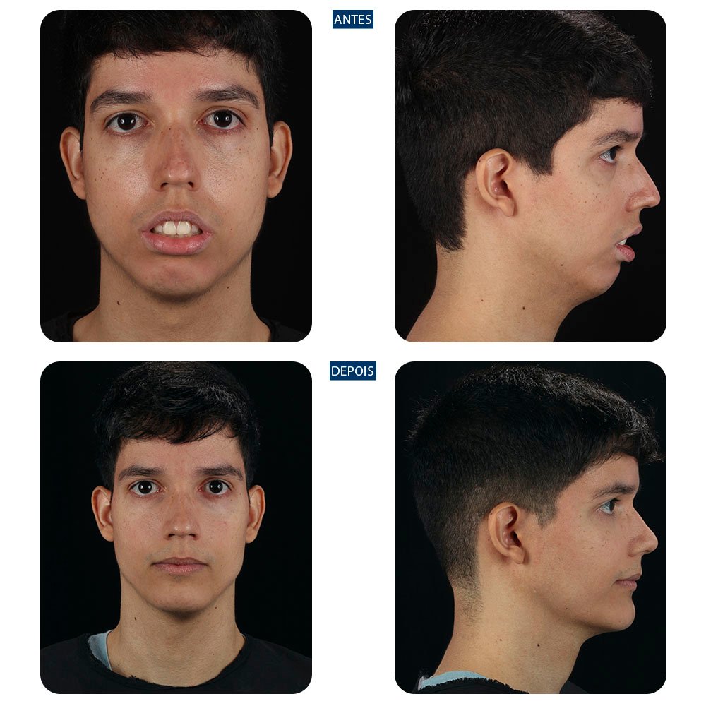Casos-novos-21
